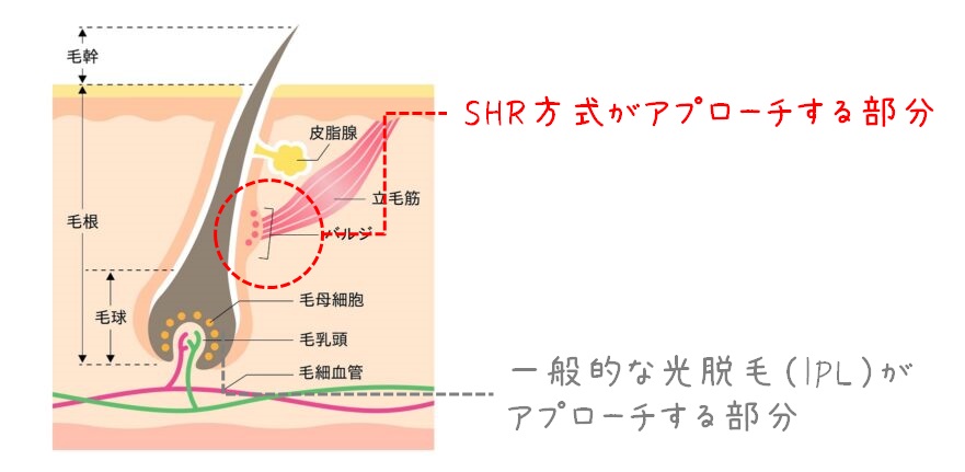 SHR方式がアプローチするバルジ体の場所を示す　図解